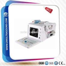 ultrasound system dawei & portable abdominal ultrasound price